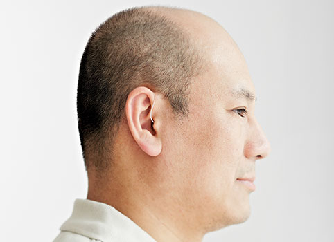 Hearing Aid Fittings